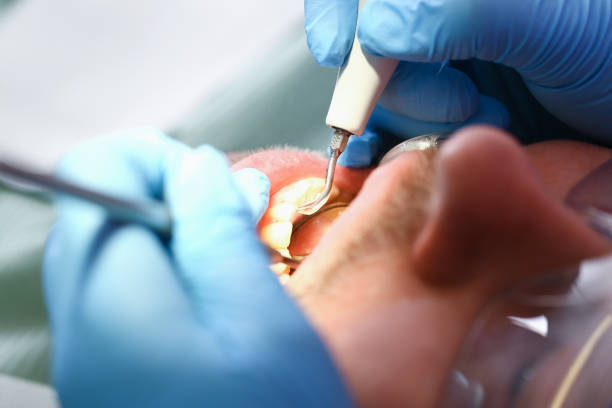 Best Emergency Dental Surgery in Columbia, MD